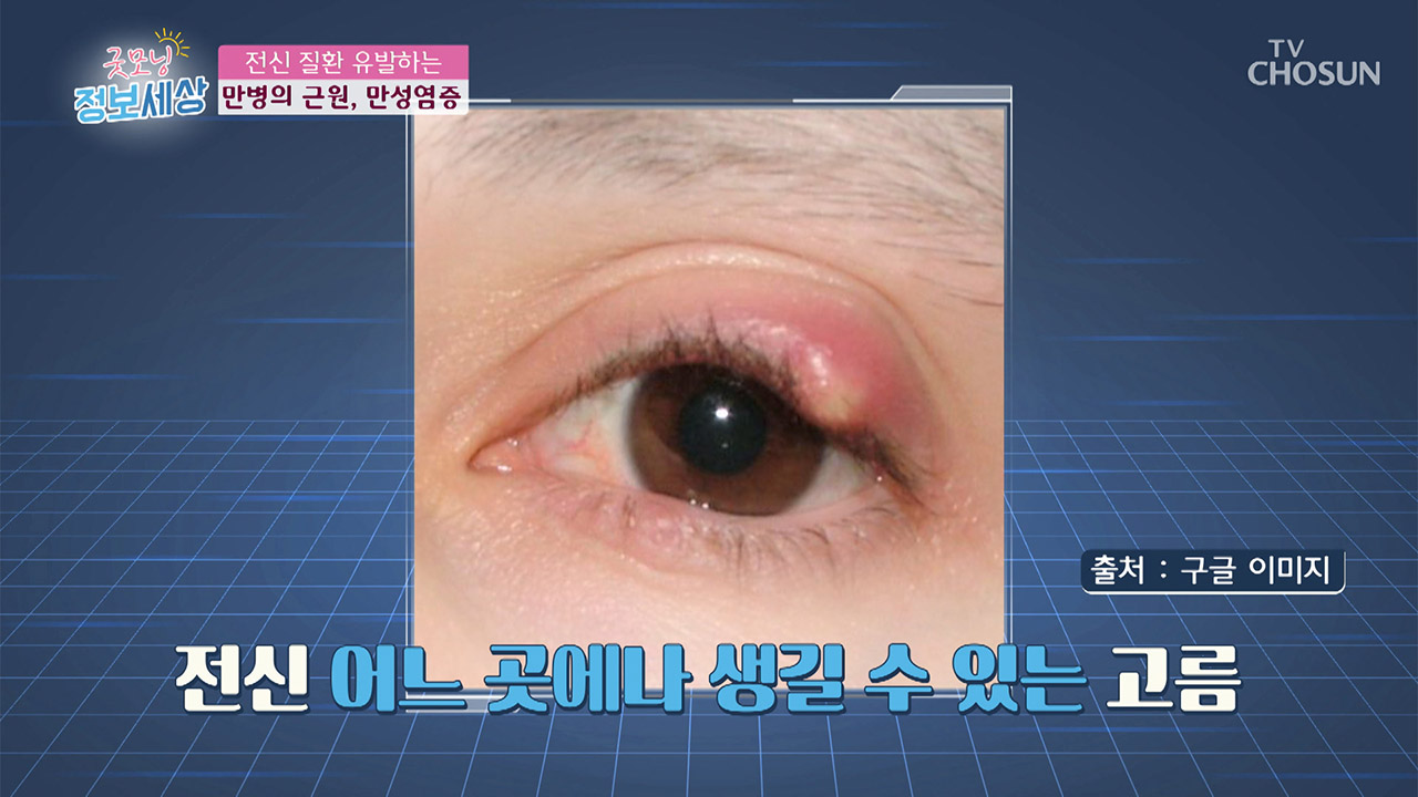 굿모닝 정보세상 명장면 상세 굿모닝 정보세상 93회 - 고단백 저지방이라 성인병 걱정 NO ‘흑염소’