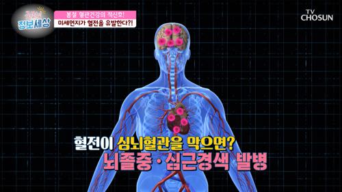 혈관을 막아 생명 위협하는 ‘혈전’이 일으키는 질병..ㄷㄷ TV CHOSUN 210409 방송