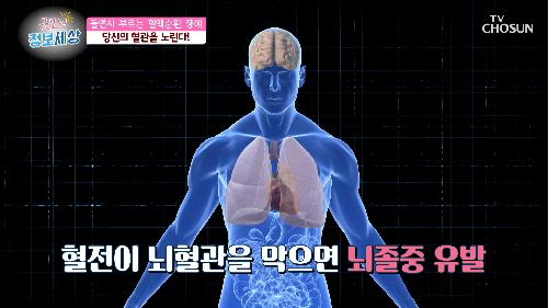 만병의 근원이 되는 ‘혈액순환 장애’ 위험성 TV CHOSUN 230811 방송