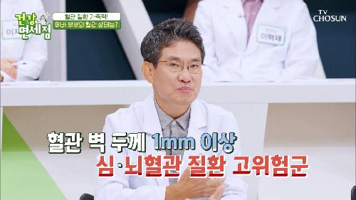 혈관 질환 가족력이 있는 에바 부부의 건강 상태는?! TV CHOSUN 20210815 방송