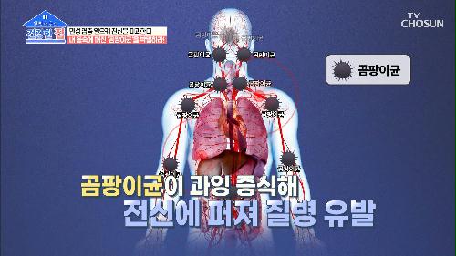 몸 속 ‘균’이 있다? 면역력이 저하되면 생기는 ˹곰팡이균˼ TV CHOSUN 20211122 방송