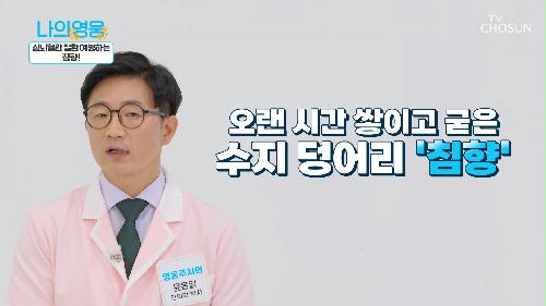 혈관에 쌓이는 찌꺼기를 청소해 주는 '침향' TV CHOSUN 220920 방송