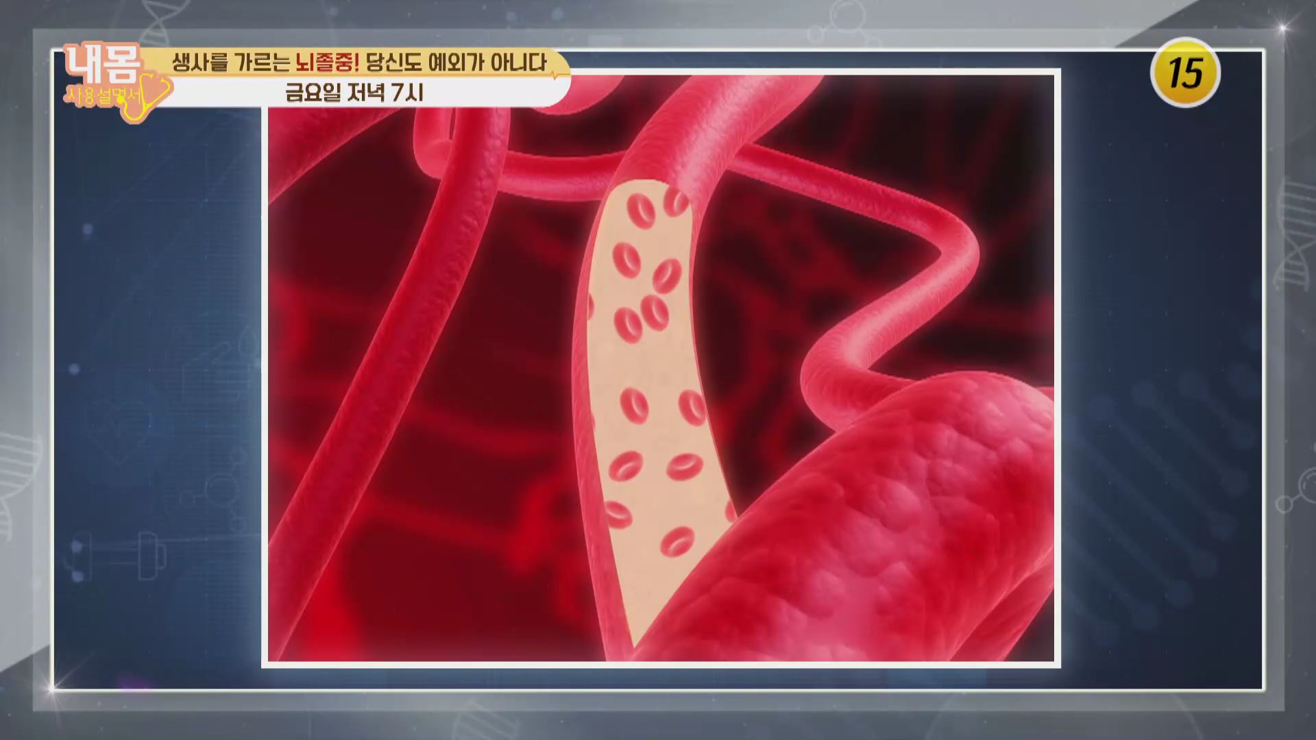 생사를 가르는 뇌졸중! 당신도 예외가 아니다_내 몸 사용 설명서 332회 예고  이미지