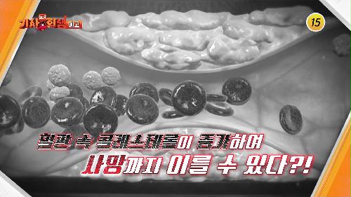 다시 사는 이야기 기사회생 30회 예고 TV CHOSUN 230828 방송 이미지